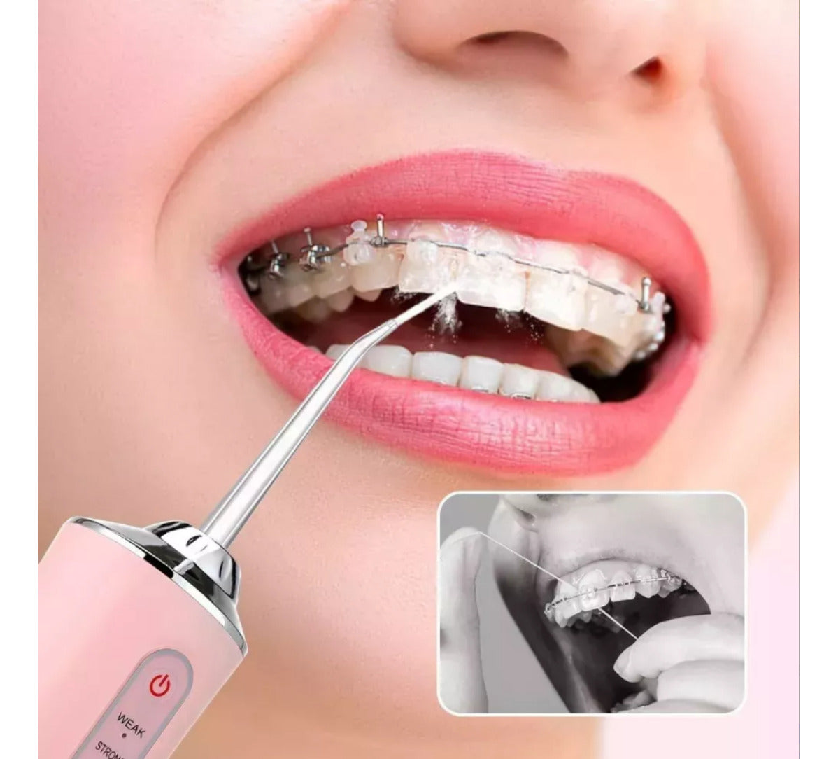 Irrigador dental